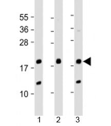 Western blot testing of human 1) A431, 2) SK-BR-3 and 3) U-2OS cell lysate with THRSP antibody at 1: