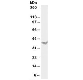 Western blot testing of rat testis lysate with DAZL antibody at 1ug/ml. Predicted molecular weight: 