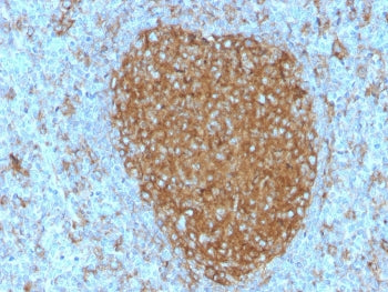 IHC staining of FFPE human tonsil with CD71 antibody (clone TFRC/3630). HIER: boil tissue sections i
