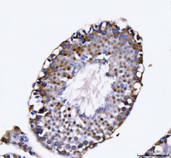 IHC staining of FFPE human testis tissue with KIFC1 antibody. HIER: boil tissue sections in pH8 EDTA