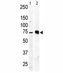 PKC beta 2 Antibody