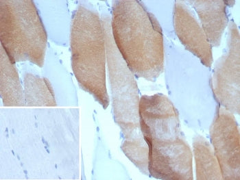 IHC staining of FFPE human skeletal muscle tissue with Myosin 7 antibody (clone MYH7/9184). Inset: P