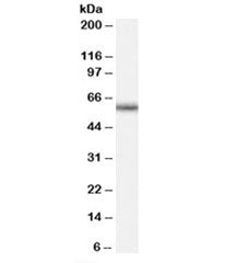 Western blot testing of human peripheral blood mononucleocyte lysate with GNRHR antibody at 0.5ug/ml