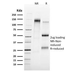 TAL1 Antibody / T-cell acute lymphocytic leukemia protein 1