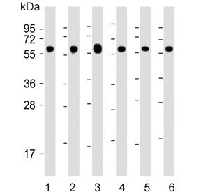 HSP60 Antibody