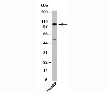 Western blot testing of human samples with CYLD antibody at 2ug/ml. Predicted molecular weight ~107k