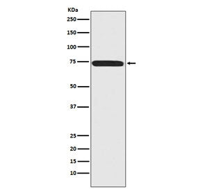 Western blot testing of human 293T cell lysate with Menin antibody. Predicted molecular weight ~68 k
