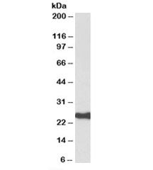 HDGFRP3 Antibody