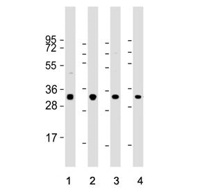 Western blot testing of human 1) HeLa, 2) HL60, 3) Jurkat and 4) MOLT4 cell lysate with Osteopontin 
