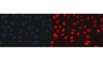 Immunofluorescent staining of FFPE human U-2 OS cells with BAF57 antibody (red) and DAPI nuclear sta