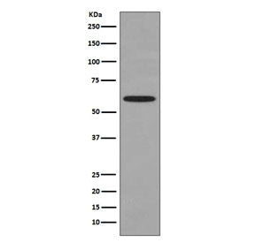 HSP60 Antibody