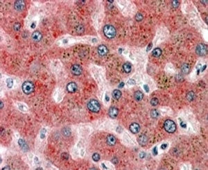 IHC staining of FFPE human liver with alpha-2-Antiplasmin antibody at 4ug/ml. HIER: steamed with pH6 citrate buffer, AP-staining.