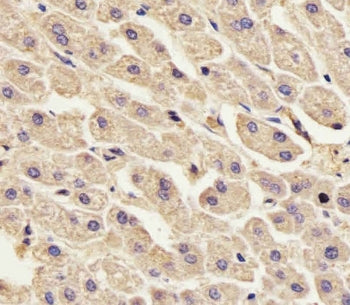 IHC testing of FFPE human liver tissue with Annexin A2 antibody. HIER: steam section in pH6 citrate 