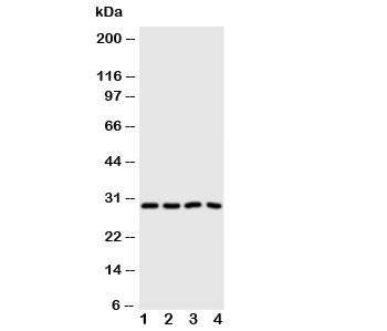 Western blot testing of Carbonic Anhydrase III antibody and Lane 1: SMMC-7721; 2: HeLa; 3: SW620; 4: SCG cell lysate. Predicted/observed molecular weight ~29 kDa.