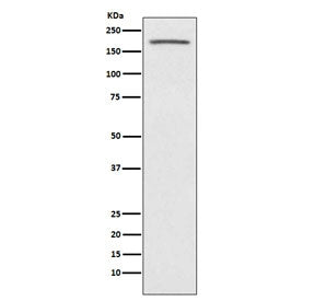 ACE Antibody / Angiotensin-Converting Enzyme