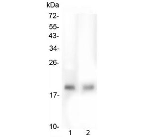 TMEM166 Antibody / EVA1A