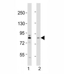 DYRK1A Antibody