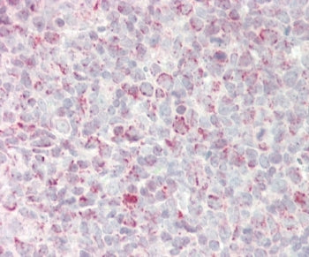 GADD45A Antibody