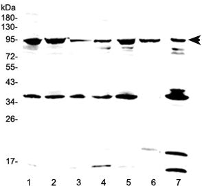 FES Antibody / Tyrosine-protein kinase Fes/Fps