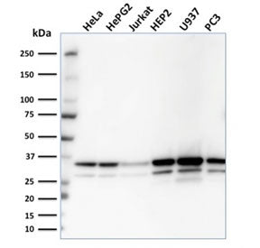 Western blot testing of human samples with MDH1 antibody. Predicted molecular weight: ~36 kDa.