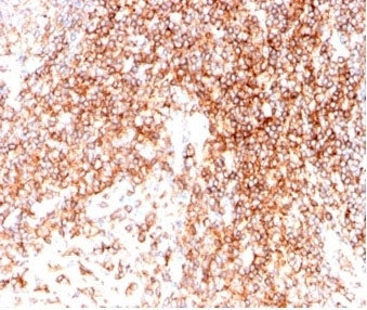 IHC staining of FFPE human tonsil tissue with CD48 antibody (clone CD48/4786). HIER: boil tissue sec