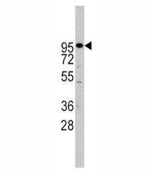 ADAM17 Antibody