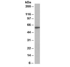 Western blot testing of Jurkat lysate with CORO1A antibody at 0.3ug/ml. Predicted molecular weight: 
