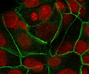 E-Cadherin Antibody / CDH1