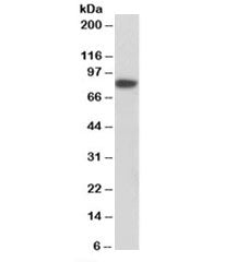 Western blot testing of MCF7 nuclear lysate with Coilin antibody at 1ug/ml. Predicted molecular weig
