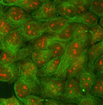 Immunofluorescent staining of FFPE human MCF7 cells with RRP1B antibody (red) and Beta Tubulin mAb (