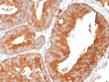 IHC staining of FFPE human spleen with SLAMF7 antibody. HIER: boil tissue sections in pH 9 10mM Tris