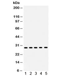 Western blot testing of human 1) MCF7, 2) MM231, 3) MM453, 4) SKOV and 5) HeLa lysate with XBP1 anti