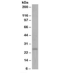 DCXR Antibody