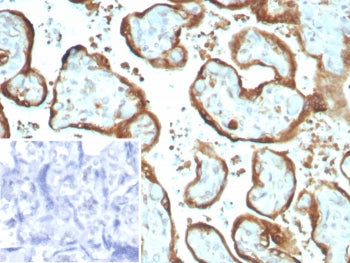 IMP3 Antibody / Insulin like growth factor 2 mRNA binding protein 3