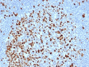 IHC staining of FFPE human lymph node tissue with recombinant Topoisomerase II alpha antibody (clone
