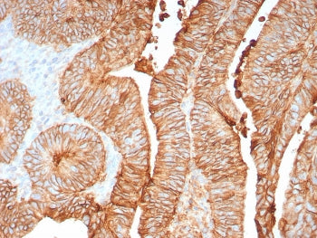 IHC staining of FFPE human colon tissue with CDH17 antibody (clone CDH17/8158R). Inset: PBS used in 