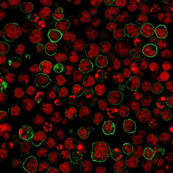 Immunofluorescent staining of human MOLT4 cells with anti-CD20 antibody (green, clone SPM618) and Re