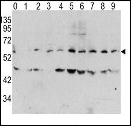 Phospho c-Myc Antibody (pT58)
