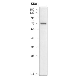 Western blot testing of human RT4 cell lysate with SCNN1A antibody. Predicted molecular weight ~76 k