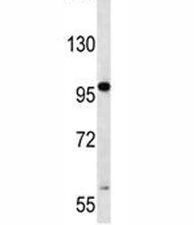 RNF43 Antibody