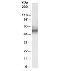 Western blot testing of human spleen lysate with TRIM11 antibody at 0.3ug/ml. Predicted molecular we