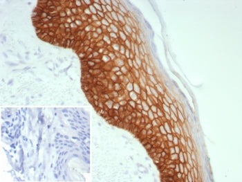 IHC staining of FFPE human skin tissue with Desmoglein 3 antibody (clone DSG3/8613R). Inset: PBS use