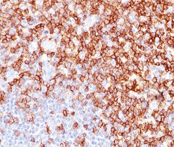 IHC testing of human tonsil stained with CD45RO antibody (UCHL-1).