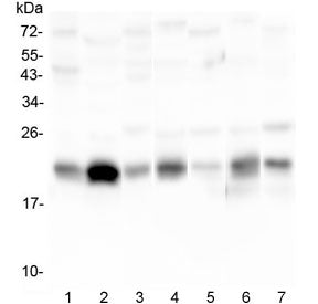Caveolin-3 Antibody / CAV3