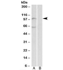 Western blot testing of human bone marrow lysate with UNC5B antibody at 2ug/ml with [B] and without 