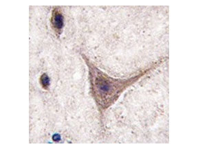 Cadherin 10 Antibody / CDH10