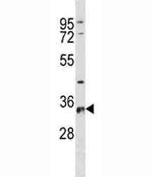 RPS6 Antibody