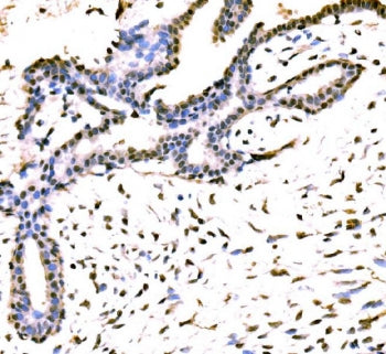 KIAA1429 Antibody / VIRMA