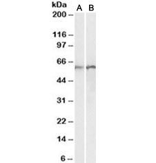 Calreticulin Antibody