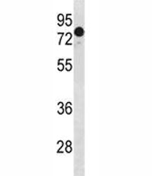 GATAD2A Antibody (p66 alpha)